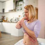 Prurito e depressione.