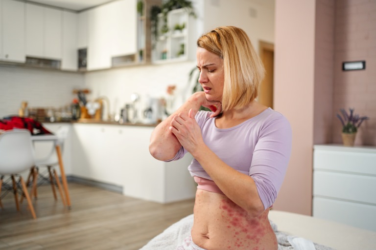 Prurito e depressione.